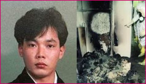 The Devastating Aftermath: Hisashi Ouchi's Autopsy Reveals Extent Of Radiation Damage